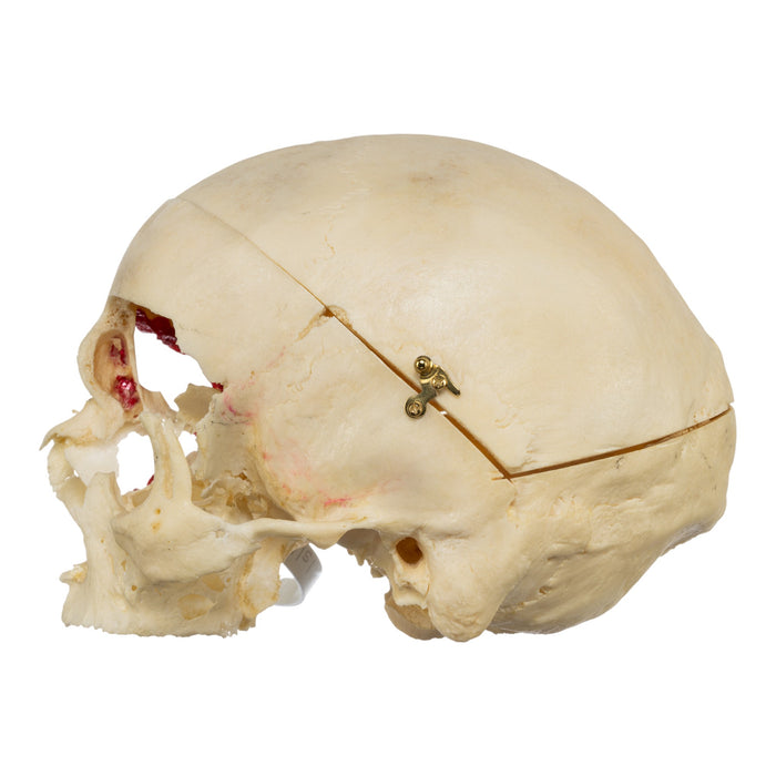 Real Human Skull - No Mandible