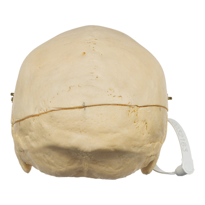 Real Human Skull - No Mandible