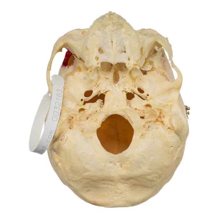 Real Human Skull - No Mandible