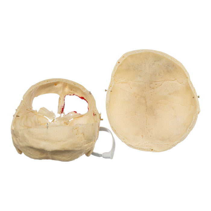 Real Human Skull - No Mandible