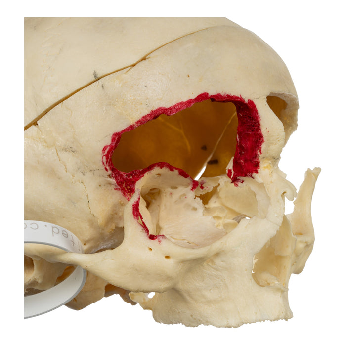 Real Human Skull - No Mandible
