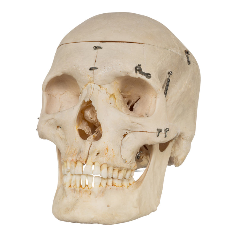 Real Human Skeleton - Disarticulated