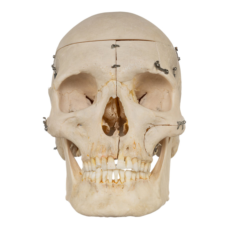 Real Human Skeleton - Disarticulated