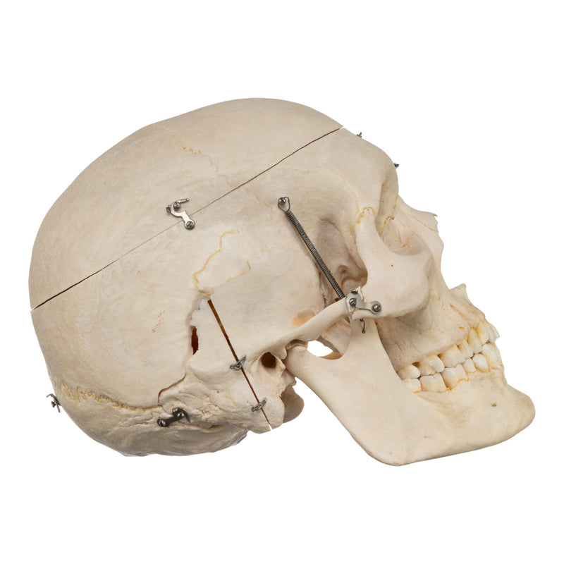 Real Human Skeleton - Disarticulated