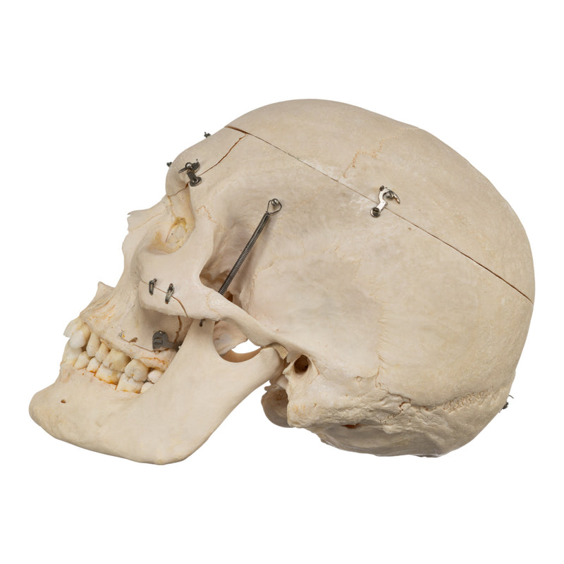 Real Human Skeleton - Disarticulated