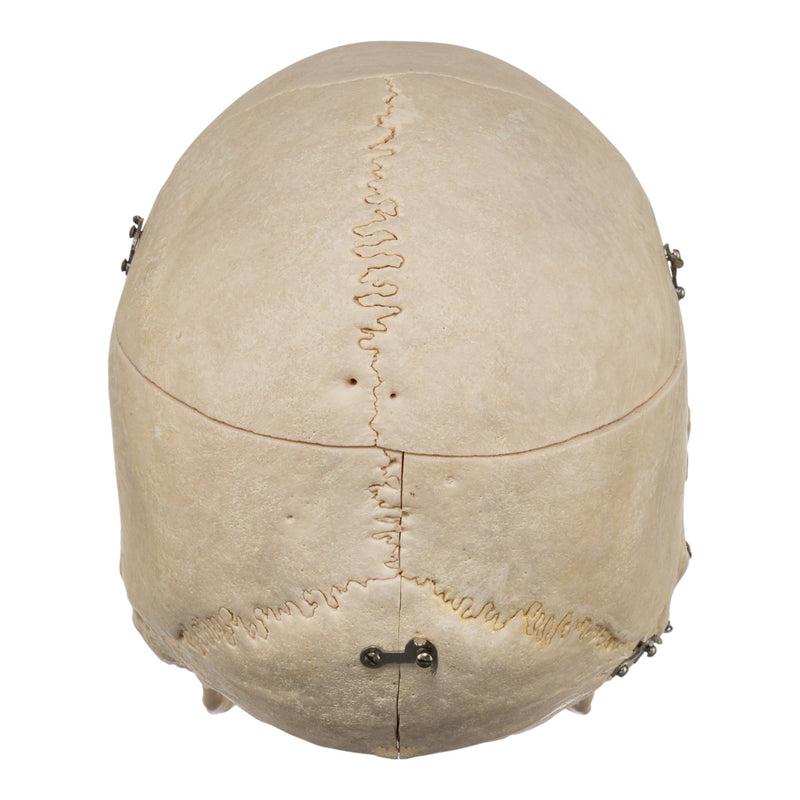 Real Human Skeleton - Disarticulated