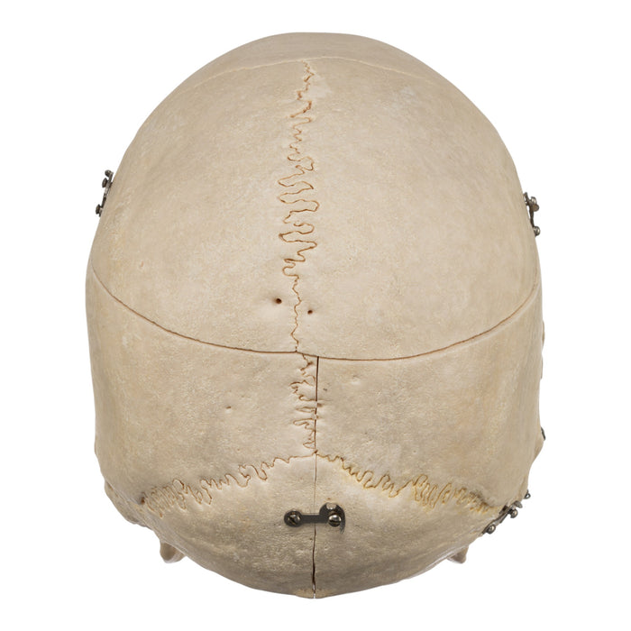 Real Human Skeleton - Disarticulated