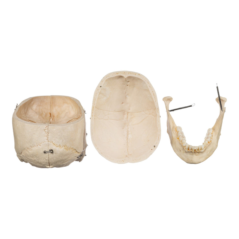 Real Human Skeleton - Disarticulated