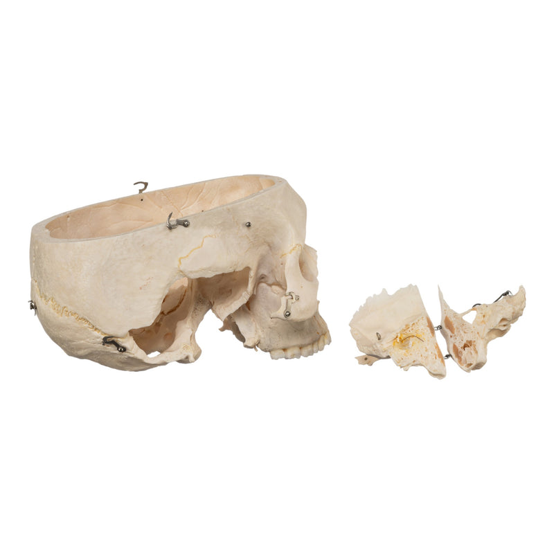 Real Human Skeleton - Disarticulated