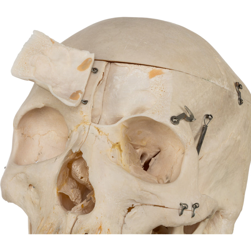 Real Human Skeleton - Disarticulated