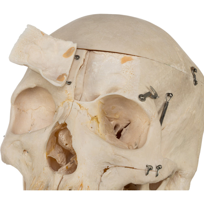 Real Human Skeleton - Disarticulated