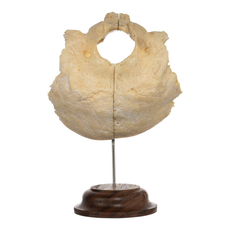 Real Human Occipital Bone on Stand