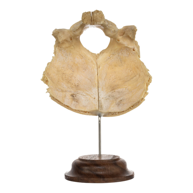 Real Human Occipital Bone on Stand