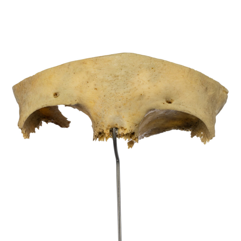 Real Human Partial Frontal Bone on Stand