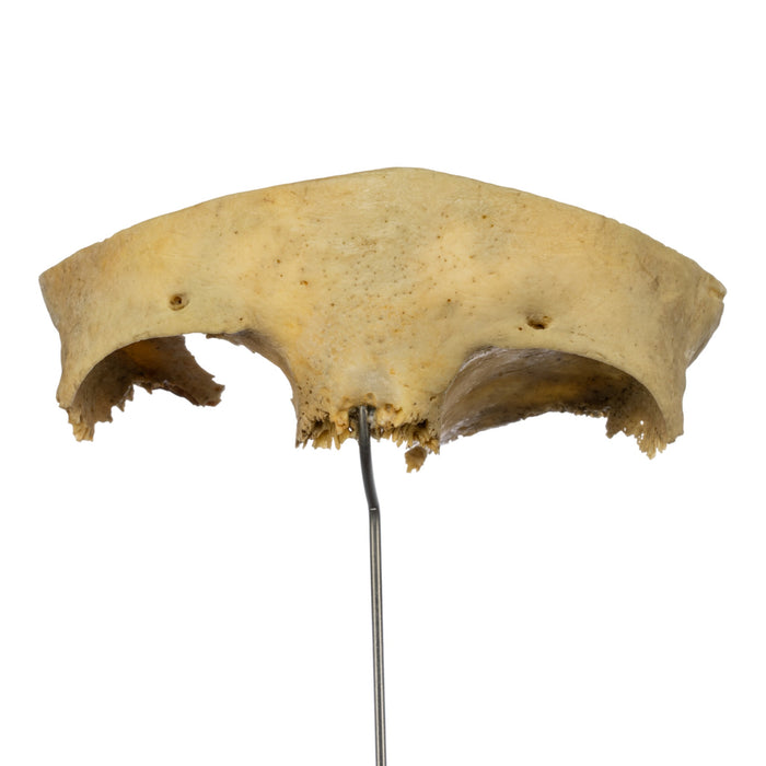 Real Human Partial Frontal Bone on Stand