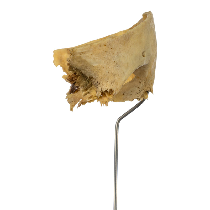 Real Human Partial Frontal Bone on Stand