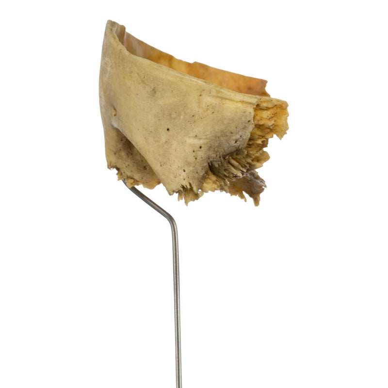 Real Human Partial Frontal Bone on Stand