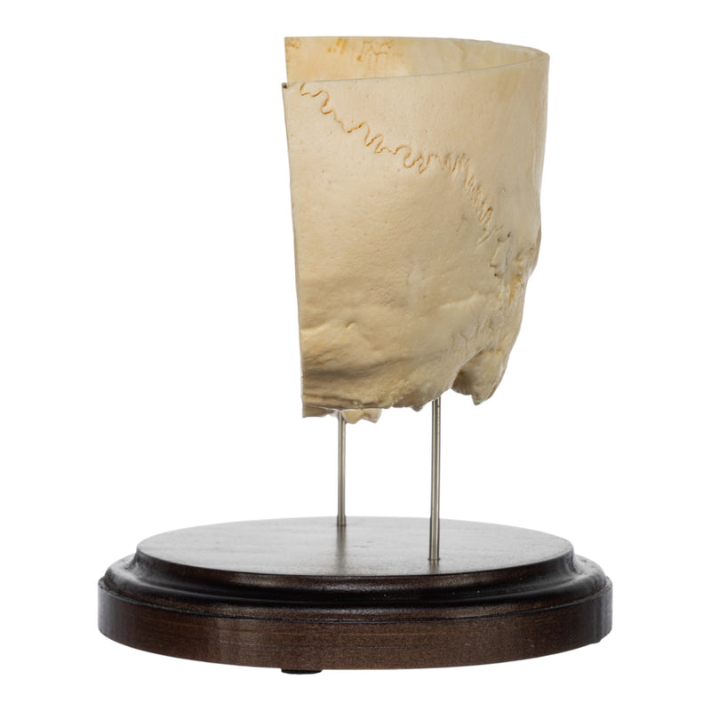 Real Human Partial Skull on Stand