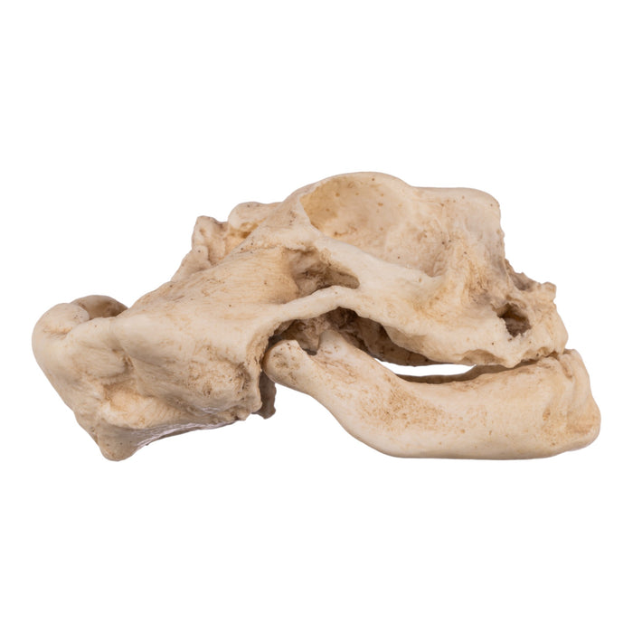 Replica Human Fetal Skull with Anencephaly