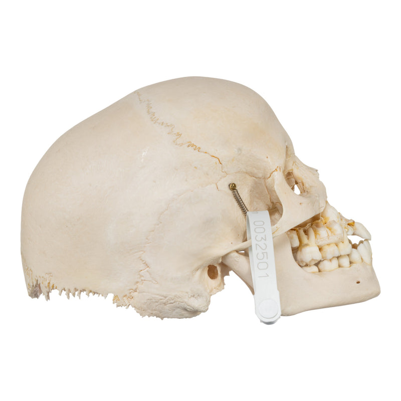 Real Human Child Skull - Damaged