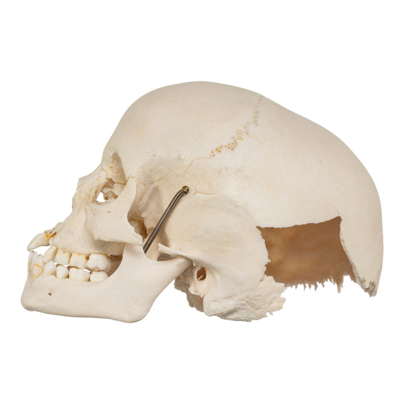 Real Human Child Skull - Damaged