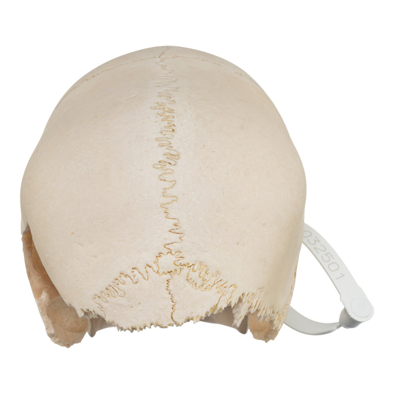 Real Human Child Skull - Damaged