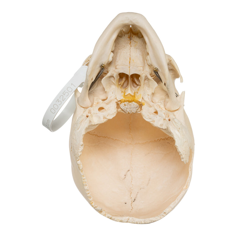 Real Human Child Skull - Damaged