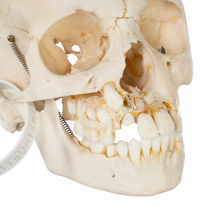 Real Human Child Skull - Damaged