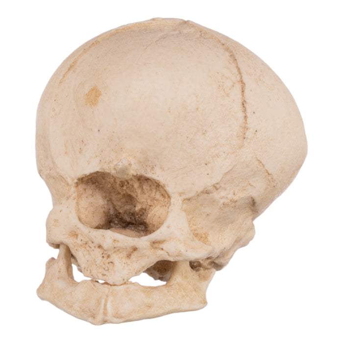 Replica Human Fetal Skull with Cyclopia