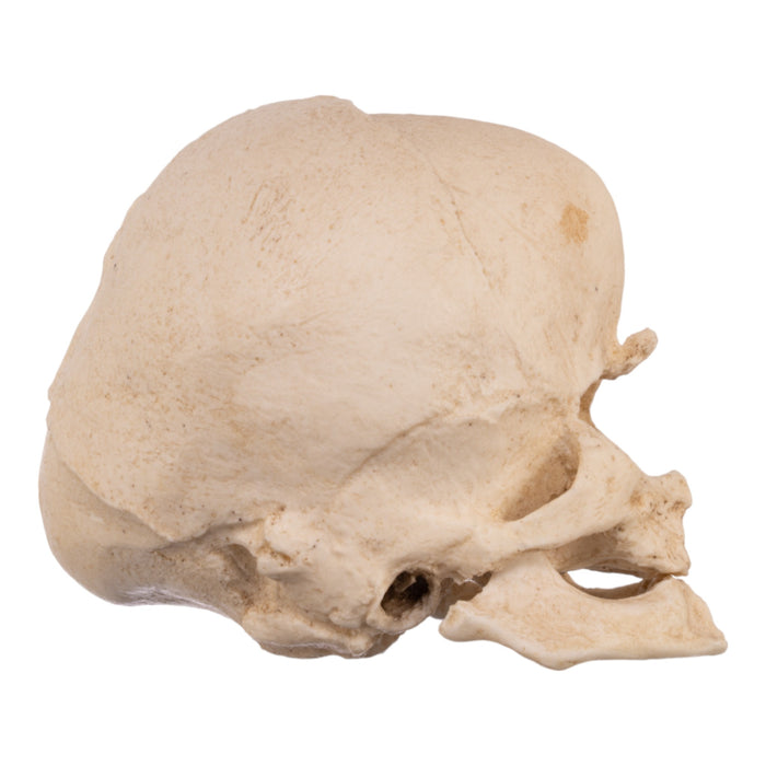 Replica Human Fetal Skull with Cyclopia