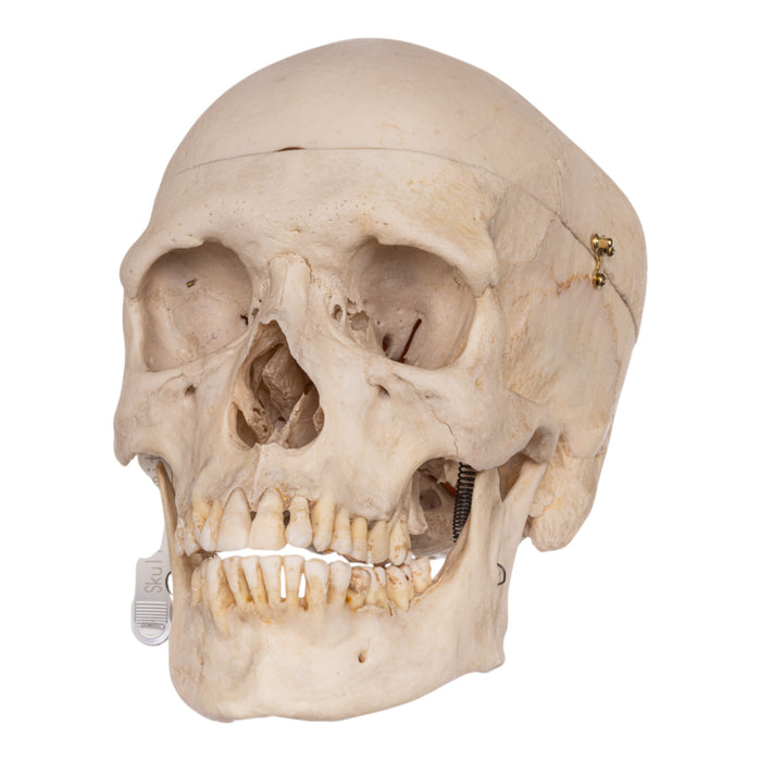 Real Human Skeleton - Disarticulated