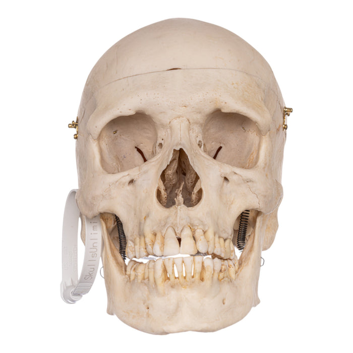 Real Human Skeleton - Disarticulated