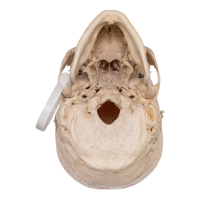 Real Human Skeleton - Disarticulated