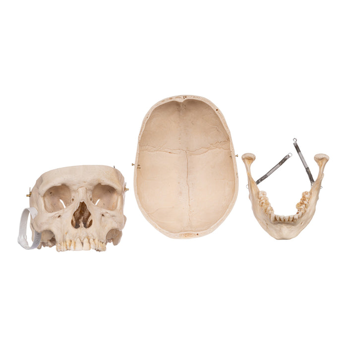 Real Human Skeleton - Disarticulated