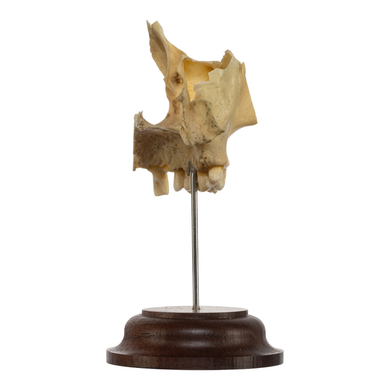 Real Human Maxillary Bone on Stand