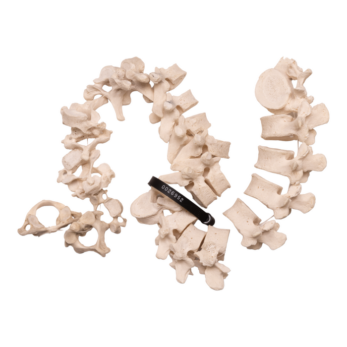 Real Human Spine - Disarticulated