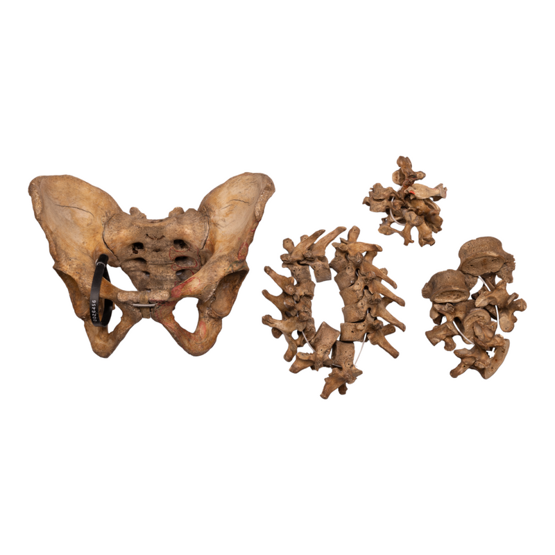 Real Human Spine, Sacrum, and Pelvis