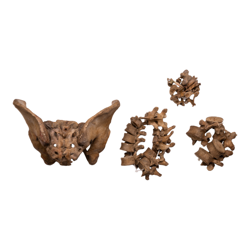 Real Human Spine, Sacrum, and Pelvis