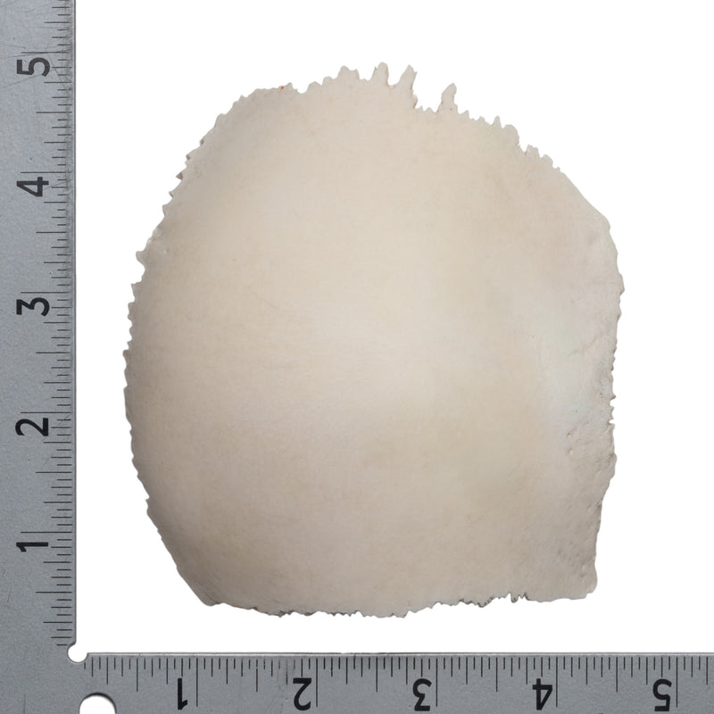 Real Human Parietal Bone