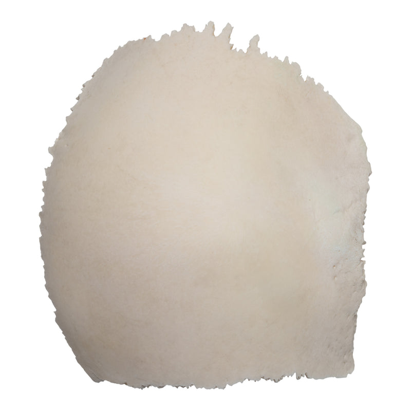 Real Human Parietal Bone