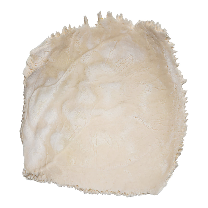 Real Human Parietal Bone