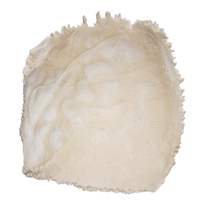 Real Human Parietal Bone