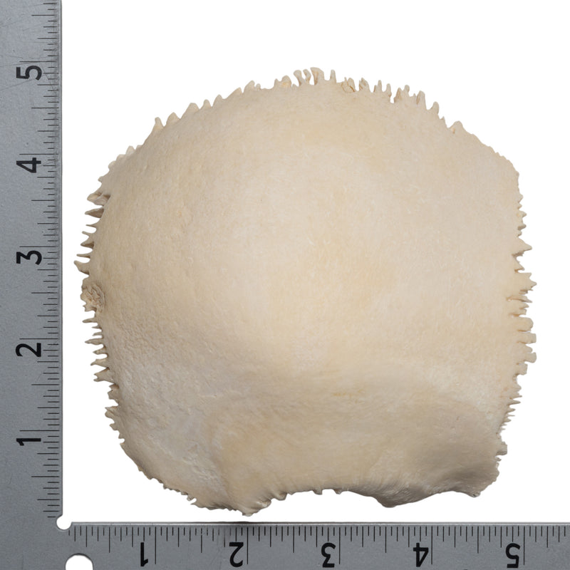 Real Human Parietal Bone