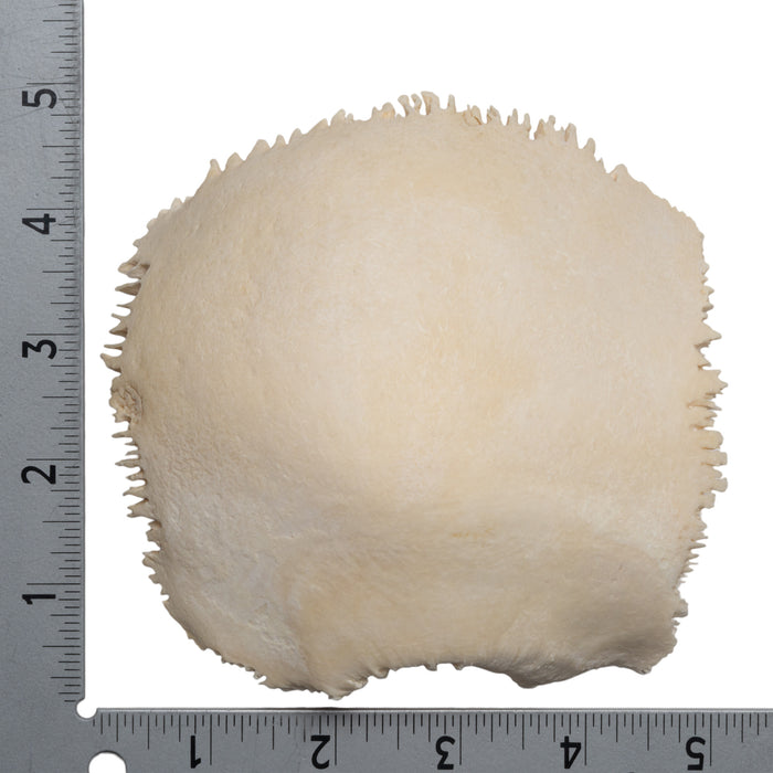 Real Human Parietal Bone