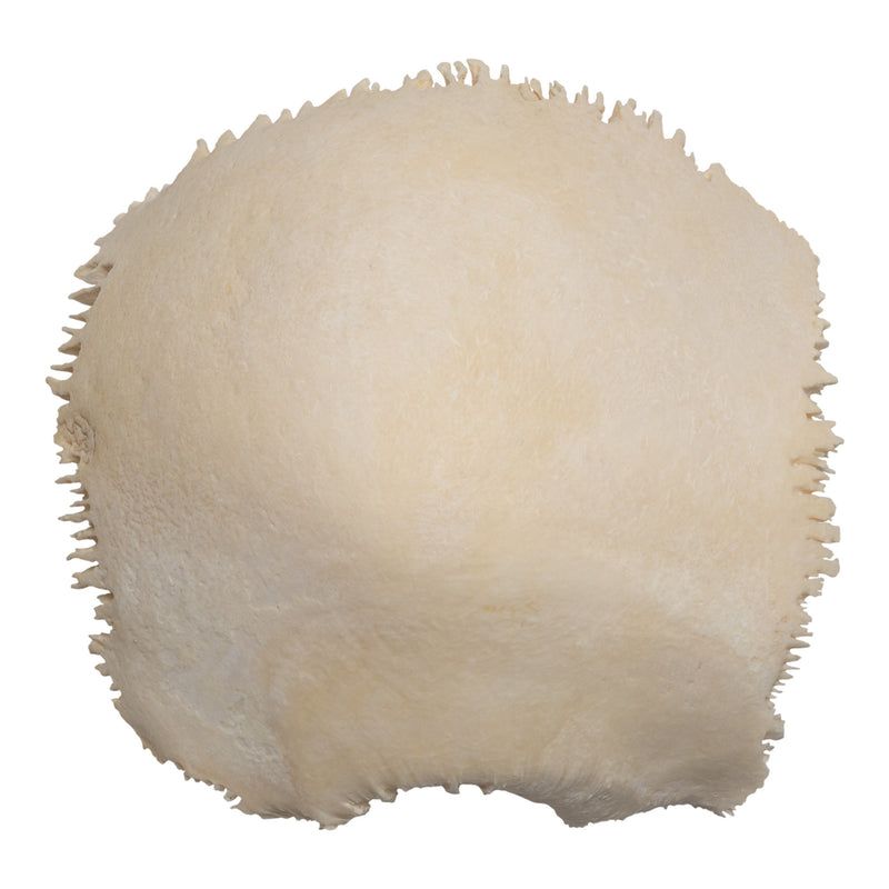 Real Human Parietal Bone