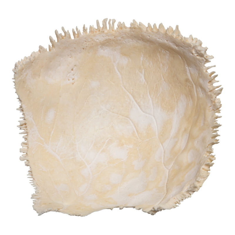 Real Human Parietal Bone