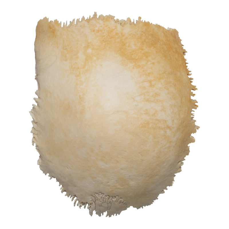 Real Human Parietal Bone