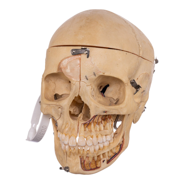 Real Dissected Human Skull With Carrying Case