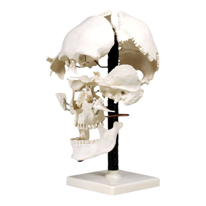 Replica Human Beauchene Skull - Economy