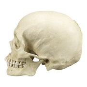 Replica Human Skull with Syphilis